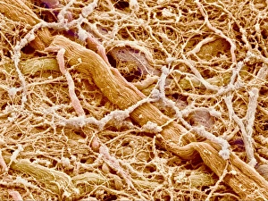 Scanning Electron Micrograph Images Drucke: Connective tissue, SEM C015 / 9928