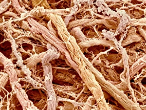 Scanning Electron Micrograph Images Drucke: Connective tissue, SEM C015 / 9933