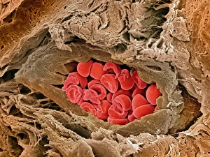 Red Blood Cell Anatomy Drucke: Coronary artery, SEM