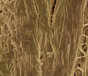 Bilder Datiert 25. Oktober 2013: Kortexknochen, SEM C017/8496