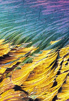 Polarised Light Microscopy Drucke: Cortisol crystals, light micrograph