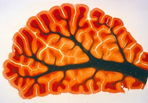 Cerebellum Anatomy Drucke: Cross-section of cortex & medulla of cerebellum