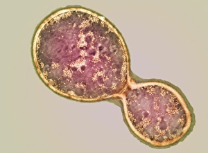 Drucke von Cryptokokkuszelle teilt sich auf. Farbige Transmission-Elektronenmikroskopaufnahme (TEM) der assexuellen Blütenbildung (rechts unten) einer Cyptococcus sp.-Hefe-Zellen Bilder Datiert 2002 August: Kryptokokuszelle teilt sich ab, TEM