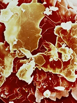 Scanning Electron Micrograph Drucke: Crystals of cholesterol