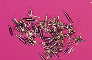 Polarisiertes Licht Drucke: Kristalle im Samenflüssigkeitsraum