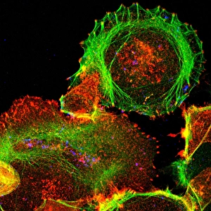 Drucke von Kultiviertes Zellgewebe. Immunfluozytisches Lichtmikroskopbild einer Epithelzelle (rund, oberer rechter Teil). Die Proteine der Zelle werden mit fluoreszierenden Farbstoffen markiert Bilder Datiert 2004 Oktober: Kulturen Zellen Lichtmikroskop