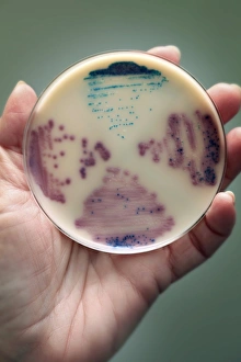 E Coli Bacteria Drucke: Cultured E. coli and Enterococcus bacteria