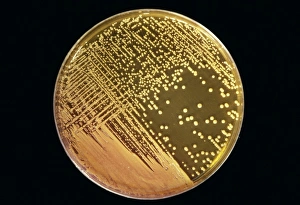 Medical Microbiology Drucke: Cultured Staphylococcus bacteria