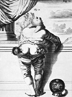 Alternative Healing Methods Drucke: Cupping, historical artwork