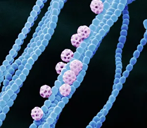 Drucke von Zyankonbakterien. Farbiges Scanning-Elektronenmikroskopbild (SEM) von Zyankonbakterien (formell als blaue grüne Algen bekannt, blau). Mehrere Sporen (rot) sind auch sichtbar Bilder Datiert 2011 März: Zyankolonbakterien im SEM