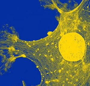 Drucke von Zytoplasmazellulose. Farbtransmissionelektronenmikroskopbild (TEM) der Zytoplasmazellulae einer menschlichen Hautzelle. Die Zellkerne befindens sich rechts im Mittelpunkt des Bildes Bilder Datiert 2011 Juli: Zytoplasmikett, TEM