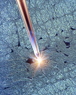Deep Brain Stimulation Drucke: Deep brain stimulation and nerve cell C016 / 7203