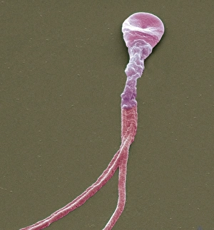 Bilder Datiert 3. März 2011: Verformter Spermienzellen, SEM