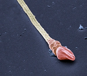 Verformter Spermienzellen, SEM
