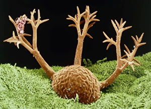 Protozoan Micrograph Drucke: Dendrocometes protozoan