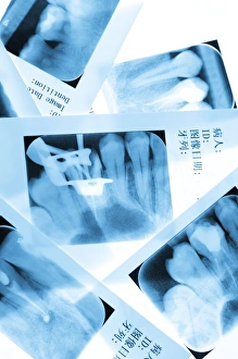 Dentist Office Equipment Drucke: Dental X-rays