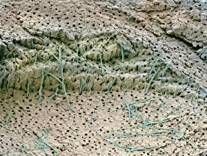 Scanning Electron Microscope Images Drucke: Dentin tooth tissue, SEM