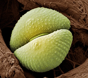 Coloured Scanning Electron Micrograph SEM Drucke: Desmid alga, SEM