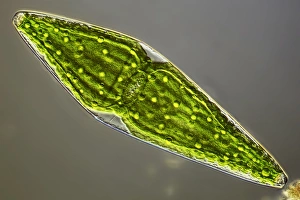 Desmid, light micrograph
