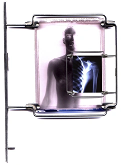 Drucke von Diagnostische Bildgebungskunstwerk des Konzepts eines menschlichen Körpers mit einem geöffneten Röntgenbild über dem Arm und Brustkorb Bilder Datiert 2004 Januar: Diagnostische Bildgebung