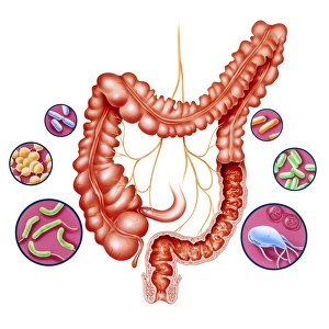 Large Intestine Anatomy Drucke: Diarrhoea, artwork