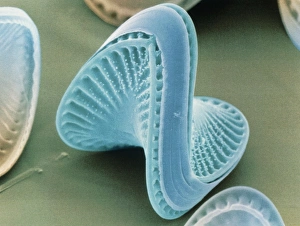 Drucke von Diatomeen. Farbener Scanning-Elektronenmikroskopbild des Diatoms Campylodiscus hibernicus. Die Diatomen sind eine charakteristische Gruppe von Einzelzellen-Algen mit etwa 10.000 Arten Bilder Datiert 2003 Oktober: Zytenalgen, Campylodiscus