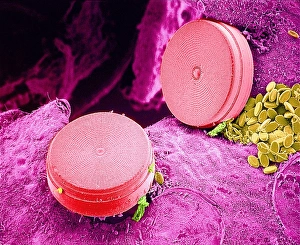 Scanning Electron Micrograph Of Diatoms Drucke: Diatom algae, SEM