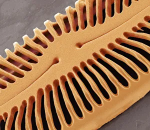 Scanning Electron Micrograph Of Diatoms Drucke: Diatom frustule, SEM