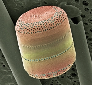 Bilder Datiert 4. Mai 2004: Diatom, SEM ist nicht übersetzbar