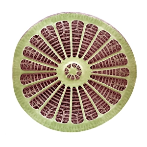 Diatom, SEM = Diatomeen (mikroskopisch)
