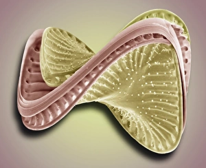 Diatom, SEM = Diatomeen im Mikroskop (Mikroscopiche Untersuchung von Diatomen)