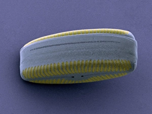 Diatom, SEM bedeutet wörtlich übersetzt zu Diatomen und Elektronenmikroskop (SEM)