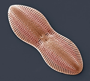 Diatom, SEM = Diatomeen unter dem Mikroskop (oder) Diatoms im Elektronenmikroskop