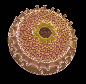 Diatom, SEM bedeutet wörtlich übersetzt Diatomee mit Elektronenmikroskop