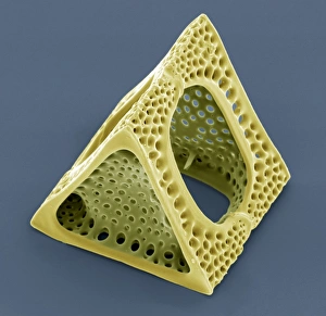 Drucke von Diatom. Farbige Rasterelektronenmikroskopaufnahme (SEM) von Triceratium sp.-Diatom. Diaten sind einzellige photosynthetische Algen, deren es etwa 100000 Arten gibt Bilder Datiert 2008 April: Diatom, SEM = Diatomen, Scanning Elektronenmikroskopie