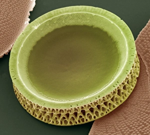Diatom, SEM = Diatomeen (Mikroskop)