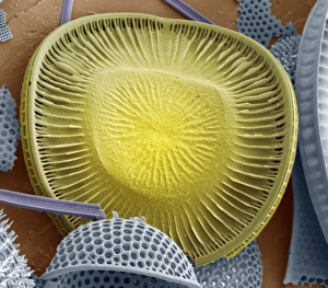 Drucke von Diatom. Farbener Scan-Elektronen-Mikroskopbild (SEM) einer Campylodiscus sp.-Diatomie (gelb), umgeben von anderen Diatomee-Arten (blau) Bilder Datiert 2009 Mai: Diatom, SEM bedeutet wörtlich übersetzt Diatomee mit Elektronenmikroskop