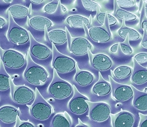 Bilder Datiert 24. Februar 2011: Diatom-Schale, SEM