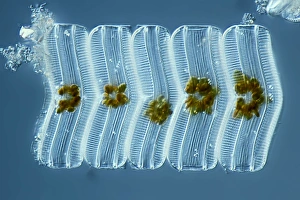 Light Micrograph Drucke: Diatoms, light micrograph C014 / 4671