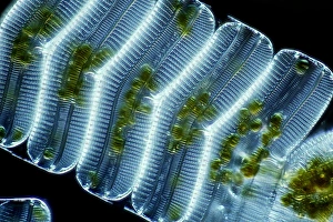 Light Microscopy Images Drucke: Diatoms, light micrograph C014 / 4674