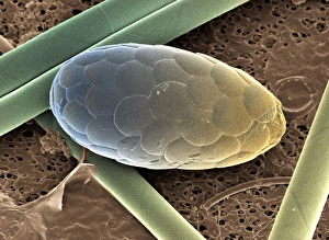 Dinoflagellaten (SEM)