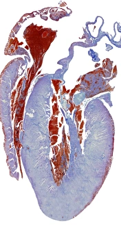 Heart Anatomy Drucke: Dissected heart, light micrograph