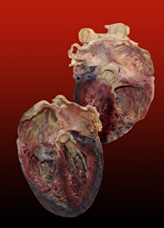 Human Heart Anatomy Drucke: Dissected human heart