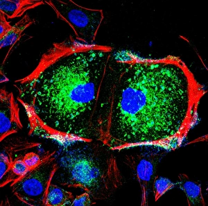 Cell Division Drucke: Dividing cell, light micrograph