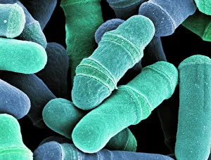 DNA Drucke: Zerlegung von Hefezellen im SEM