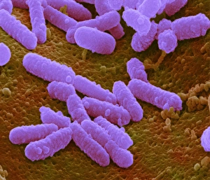 Escherichia coli Bakterien