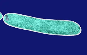 Coloured TEM Images Drucke: E. coli bacterium, TEM