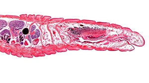Lumbricus Terrestris Drucke: Earthworm, longitudinal section