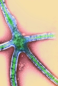 Bilder Datiert 22. April 2003: Ebolaschwamm-Infektionszyklus im Transmissionselektronenmikroskop (TEM)