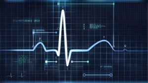 Medical Diagnostic Tool Drucke: ECG trace C017 / 7743